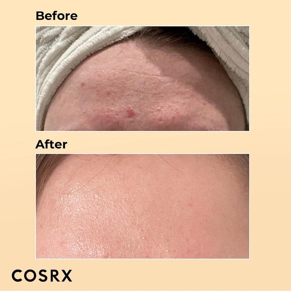 COSRX Advanced Snail 96 Mucin Power Essence 100mL NEW 🐌✨ - Picture 5 of 10